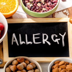 Allergen Guidance and Advice