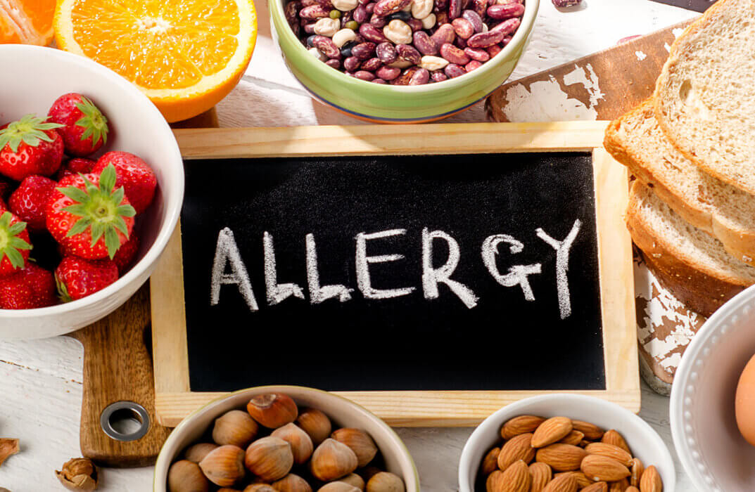 Allergen Guidance and Advice